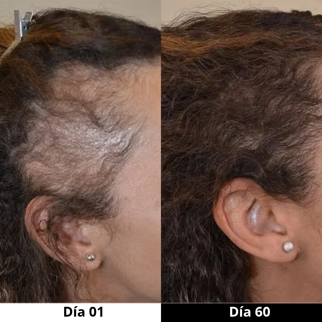 ¡¡El pelo está volviendo a crecer rapidísimo!!😍 